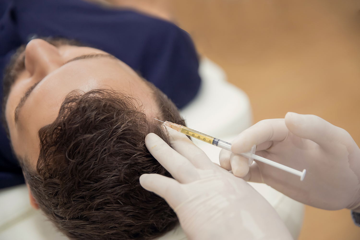 Hair mesotherapy or scalp prp: Platelet-rich plasma procedure. Beautician doctor makes injections in the man head for hair growth to prevent hair loss and baldness Hair mesotherapy or scalp prp: Platelet-rich plasma procedure. Beautician doctor makes injections in the man head for hair growth against hair loss and baldness