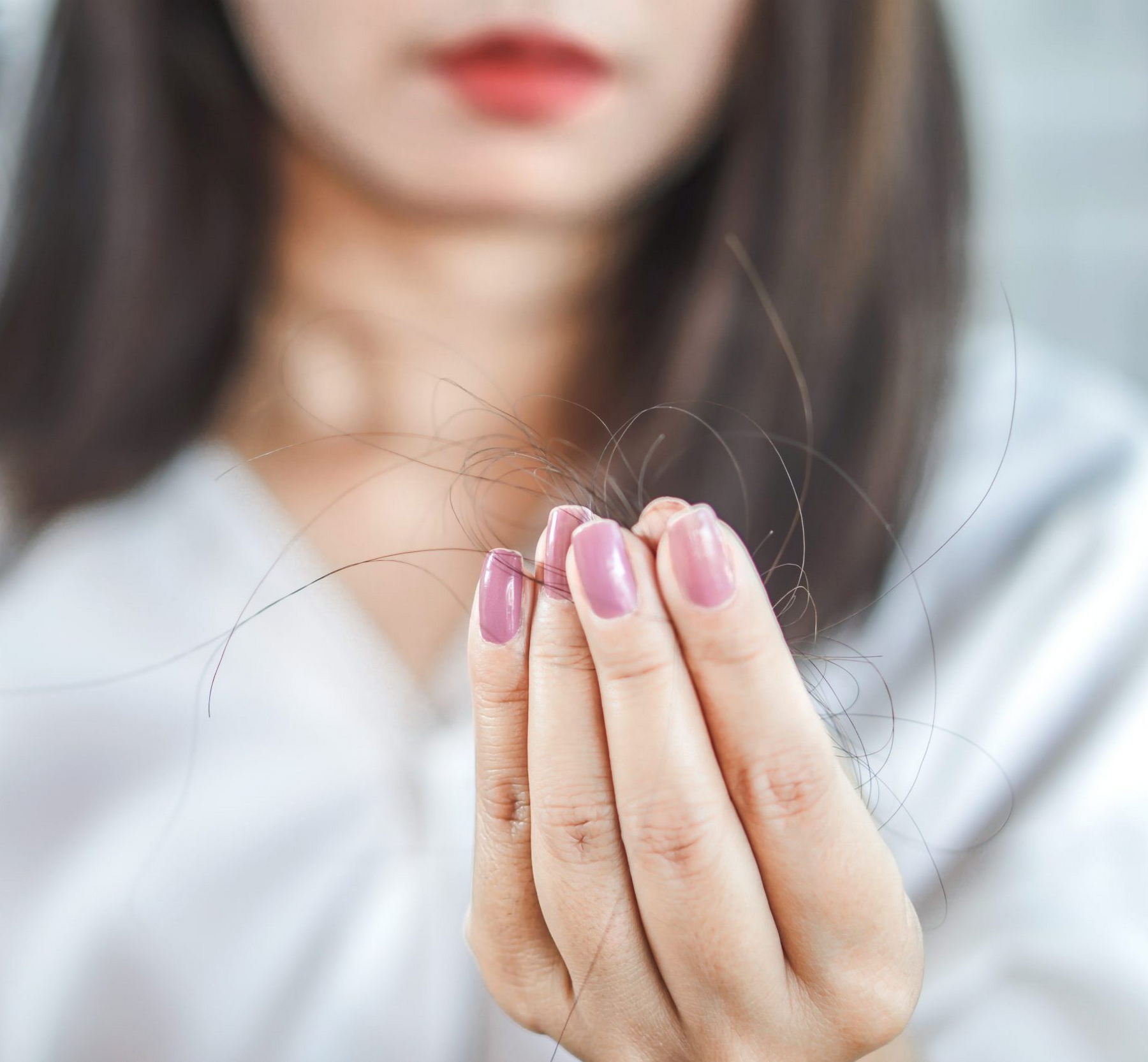 Androgenic Hair loss